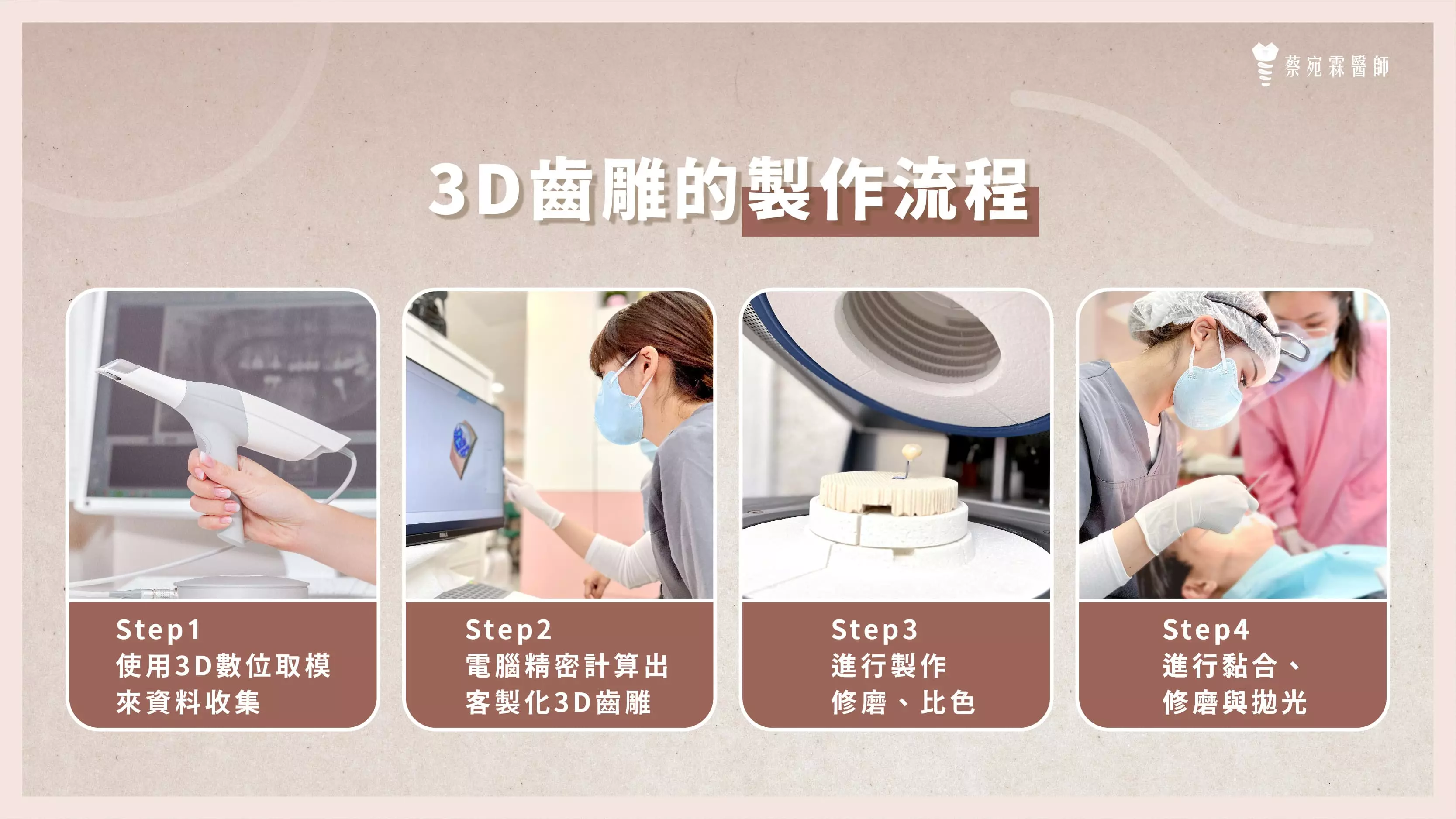3D齒雕的製作流程